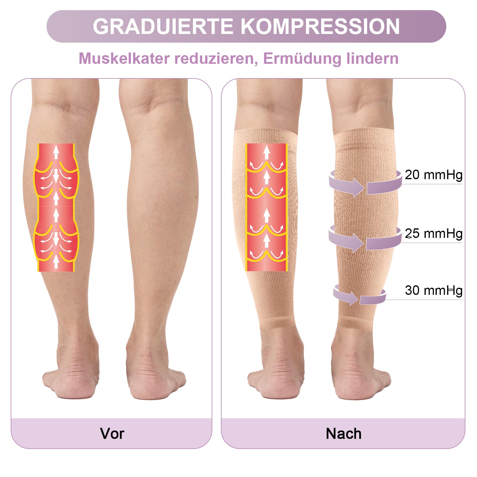 2 pares de medias de compresión para hombre y mujer, 20-30 mmHg, clase 2, medias de compresión médica, soporte graduado, medias de trombosis