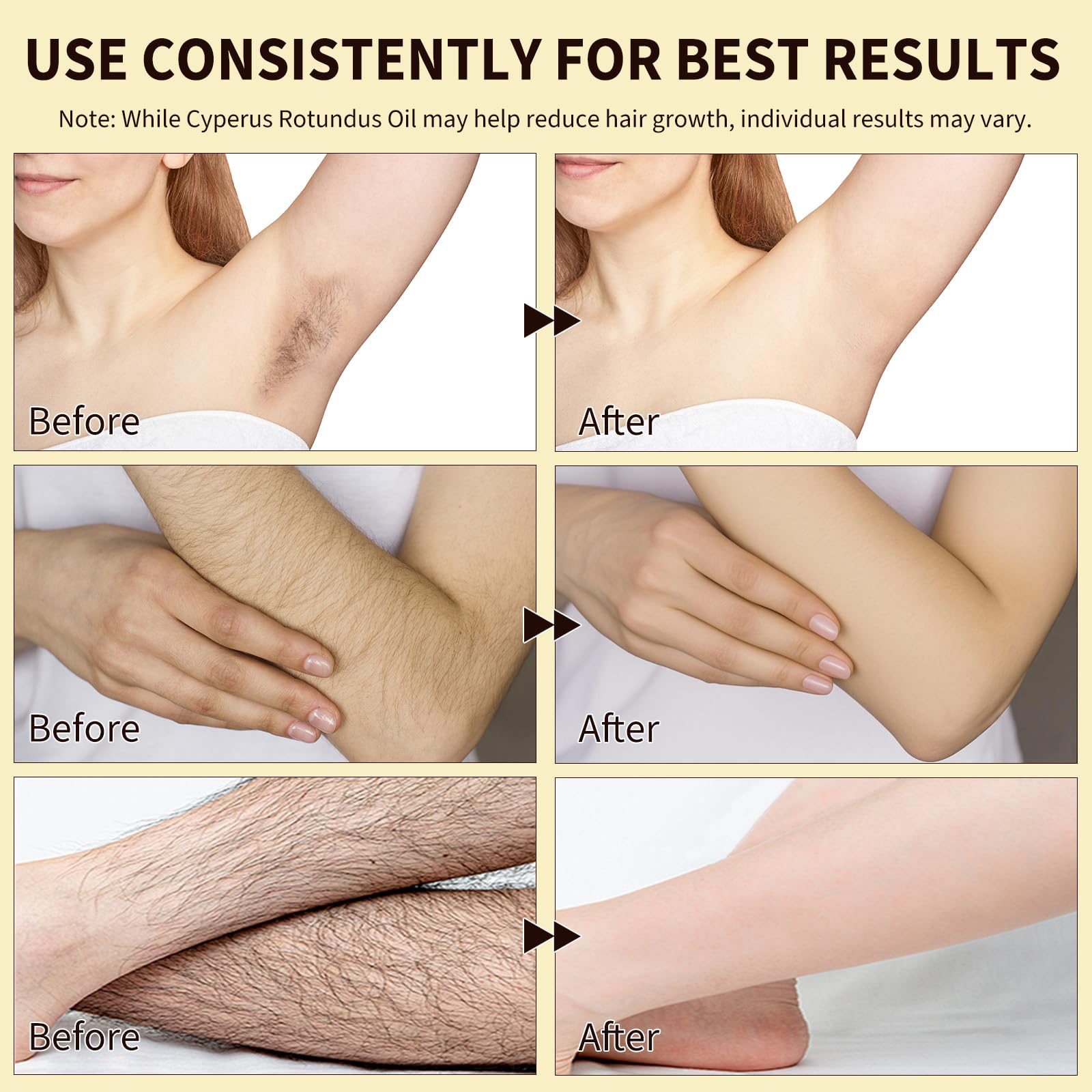 Cyperus Rotundus Olio per la depilazione, 100% puro naturale per la depilazione del corpo e del viso, per donne, riduce la crescita indesiderata dei peli dopo la barba, restringe i pori, idrata
