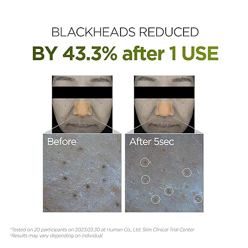 Miniatura 5 de P.CALM UnderPore - Aceite limpiador de albahaca sagrada de 6.42 onzas líquidas  Aceite limpiador instantáneo de control de poros no comedogénico con