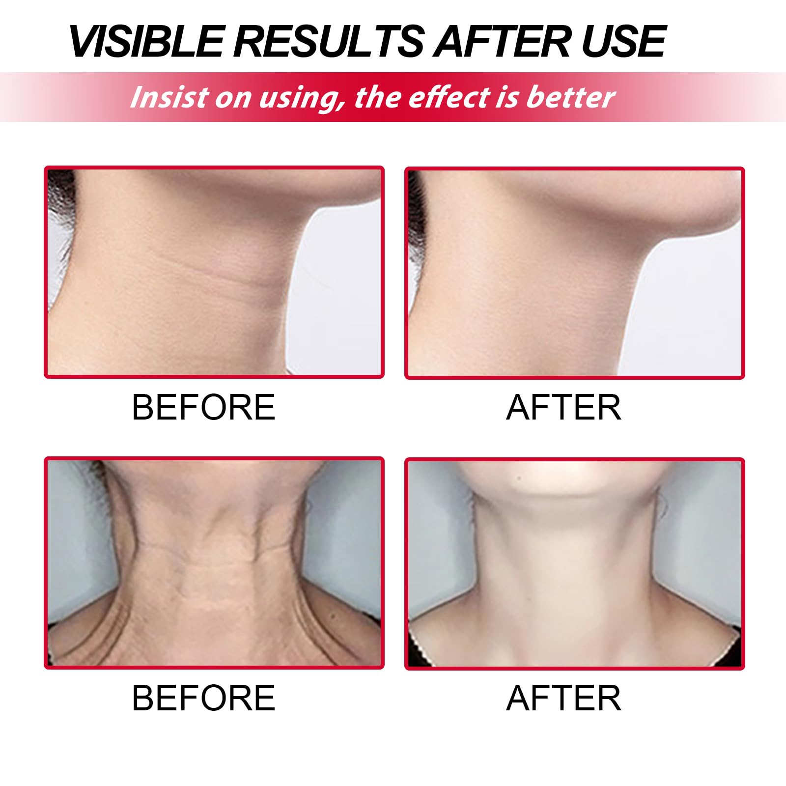 Retinol Neck Neck Facial Care - Image 3