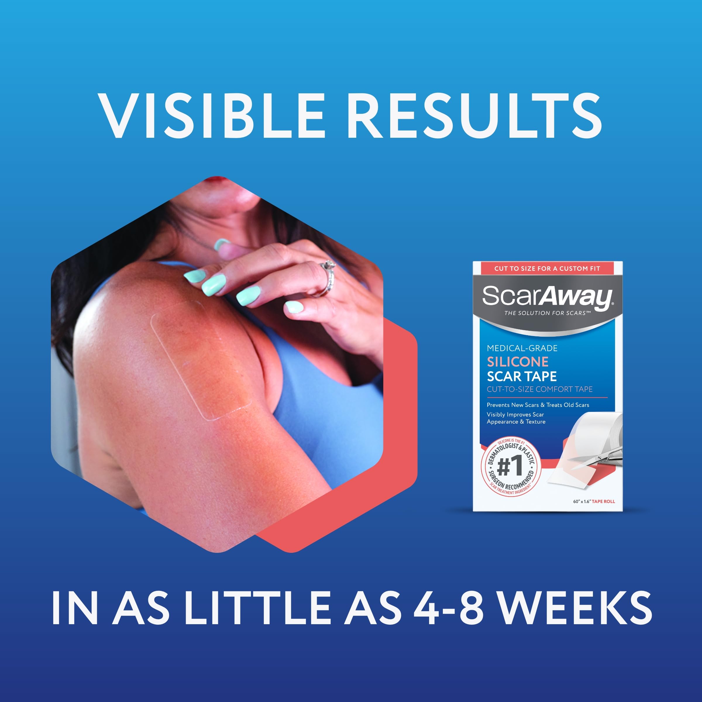 ScarAway Silicone Scar Tape - Reduce Scar Appearance -7