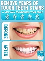 Vista 4 de Oralfree Tiras blanqueadoras de dientes naturales, blanqueador de dientes sensibles, kit de blanqueamiento de dientes seguro con peróxido