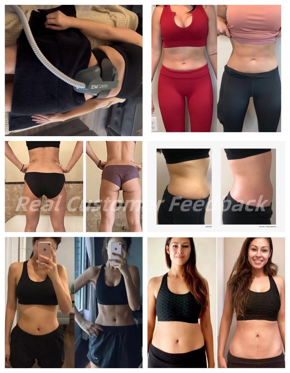 Dispositivo profesional de electroestimulación muscular para moldear el cuerpo: Un dispositivo de estimulación electromagnética que se utiliza para aliviar la rigidez muscular y reducir la grasa.