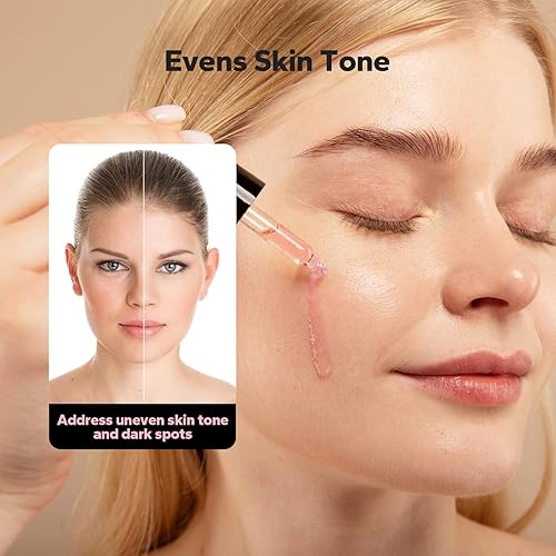 Miniatura 3 de Suero de niacinamida (1 onza líquida), 10% niacinamida + 4% ácido tranexámico, suero facial para minimizar los poros, manchas oscuras, eliminación