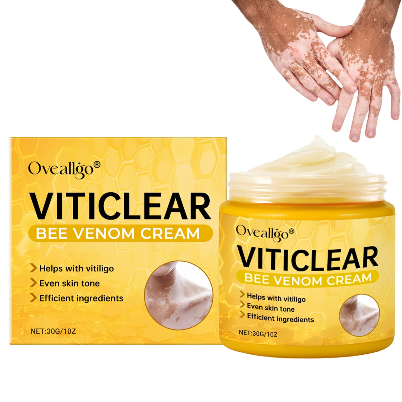Oveallgo Viticlear Bee Venom Cream, Professional Vitiligo Cream, Bee Venom Skin Treatment cream, Reduce White Spots and Improve Skin Pigmentation, Natural Serum Suitable for All Skin Types (1 Pack)