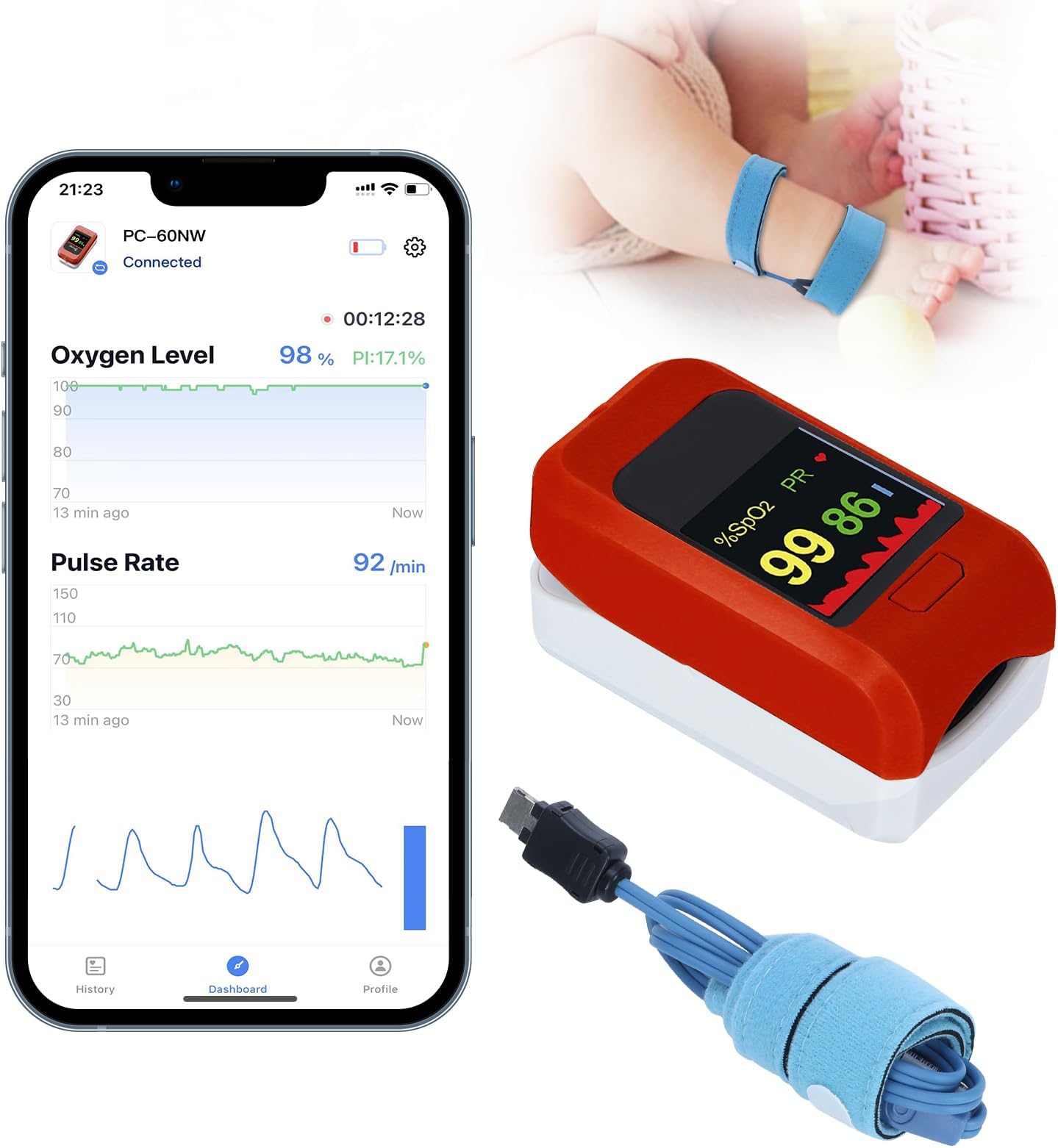 TATOAOWAWBaby Oxygen Monitor with Bluetooth App, Tracks Baby's Heart Rate, O2, Sleep Monitor, Adjustable Foot Band for 0-36 Months Infant