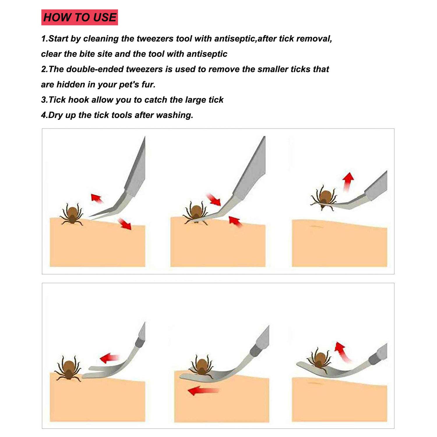 YOUYIKE® Pinzas para garrapatas,Acero Inoxidable Pet Perros Gatos garrapatas Remover Kit,3 Premium tickremover + Caja de Almacenamiento