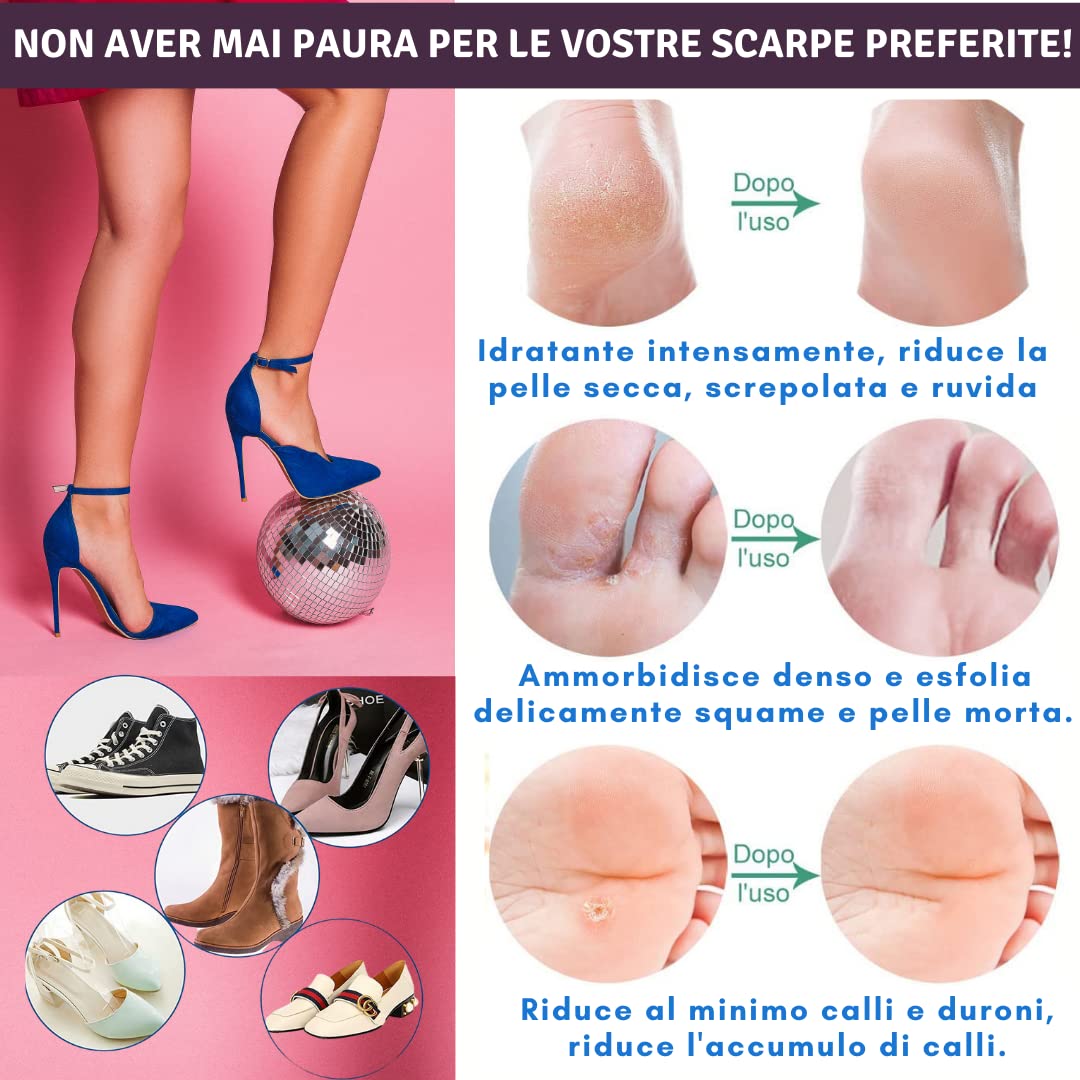 Crema Urea 30%, 100ml, Eczemi, Cheratosi, Psoriasi, Eruzioni Cutanee, Dermatite, Prurito, Piedi Secchi, Talloni Screpolati, Calli, Duroni | Idratazione Profonda | Vitamin A, E, Burro di karitè