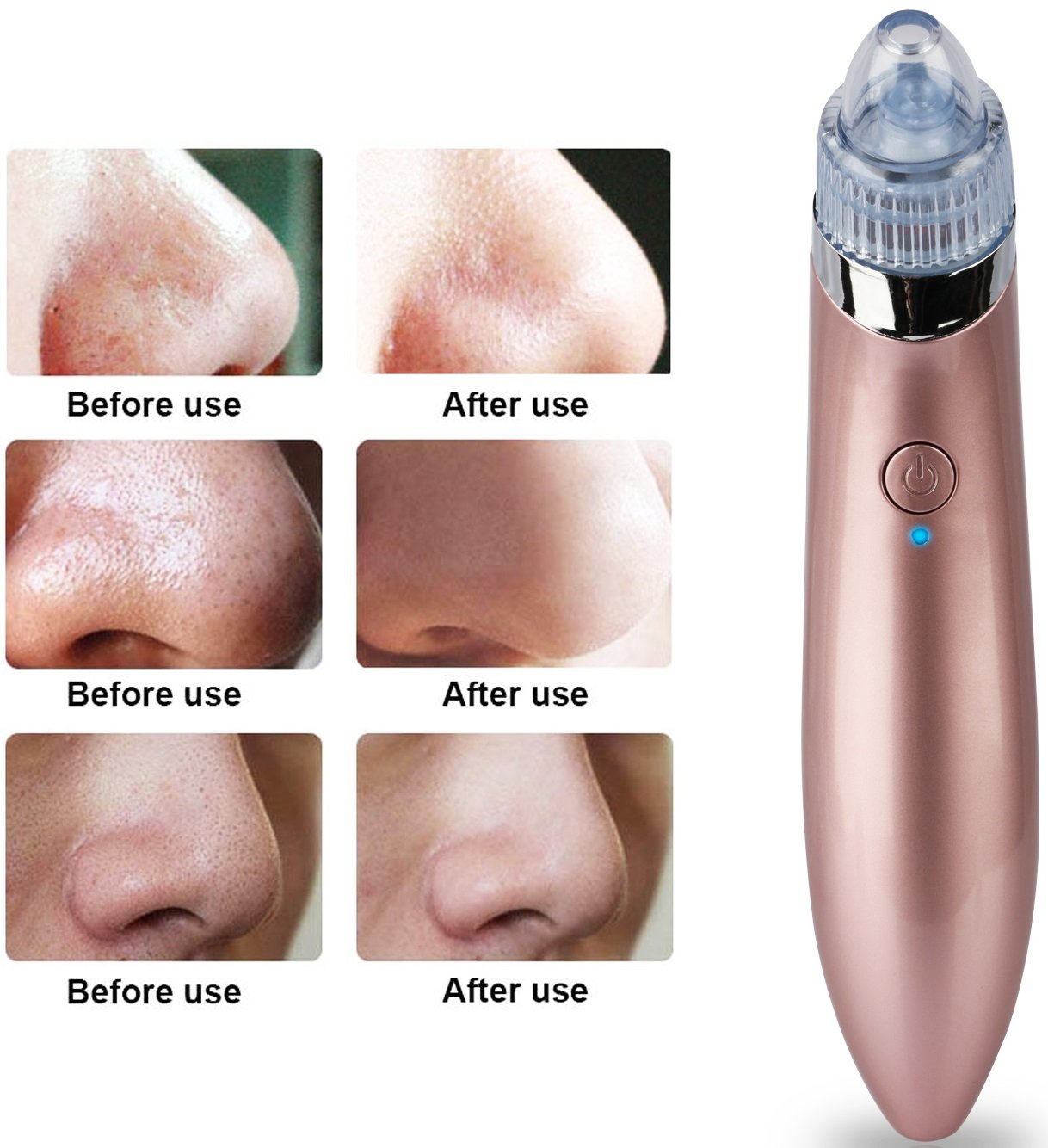 GPCT Electric Facial Pore Cleaner Blackhead Vacuum Suction Remover
