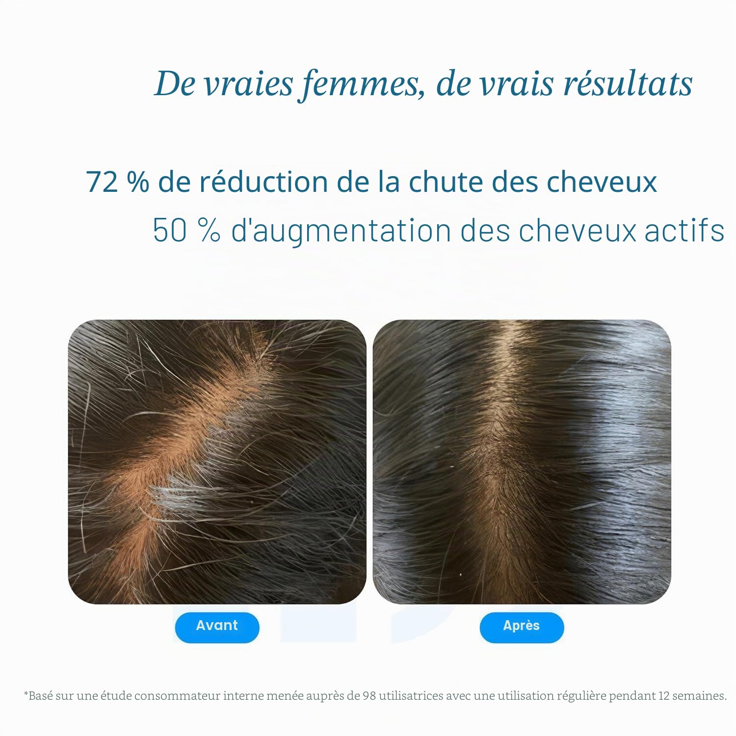 Be Bodywise Sérum pour la croissance des cheveux (Roll On) 3% Redensyl & 2% Anagain Contrôle de la chute des cheveux pour femmes et hommes Favorise la croissance des cheveux et stimule les follicules