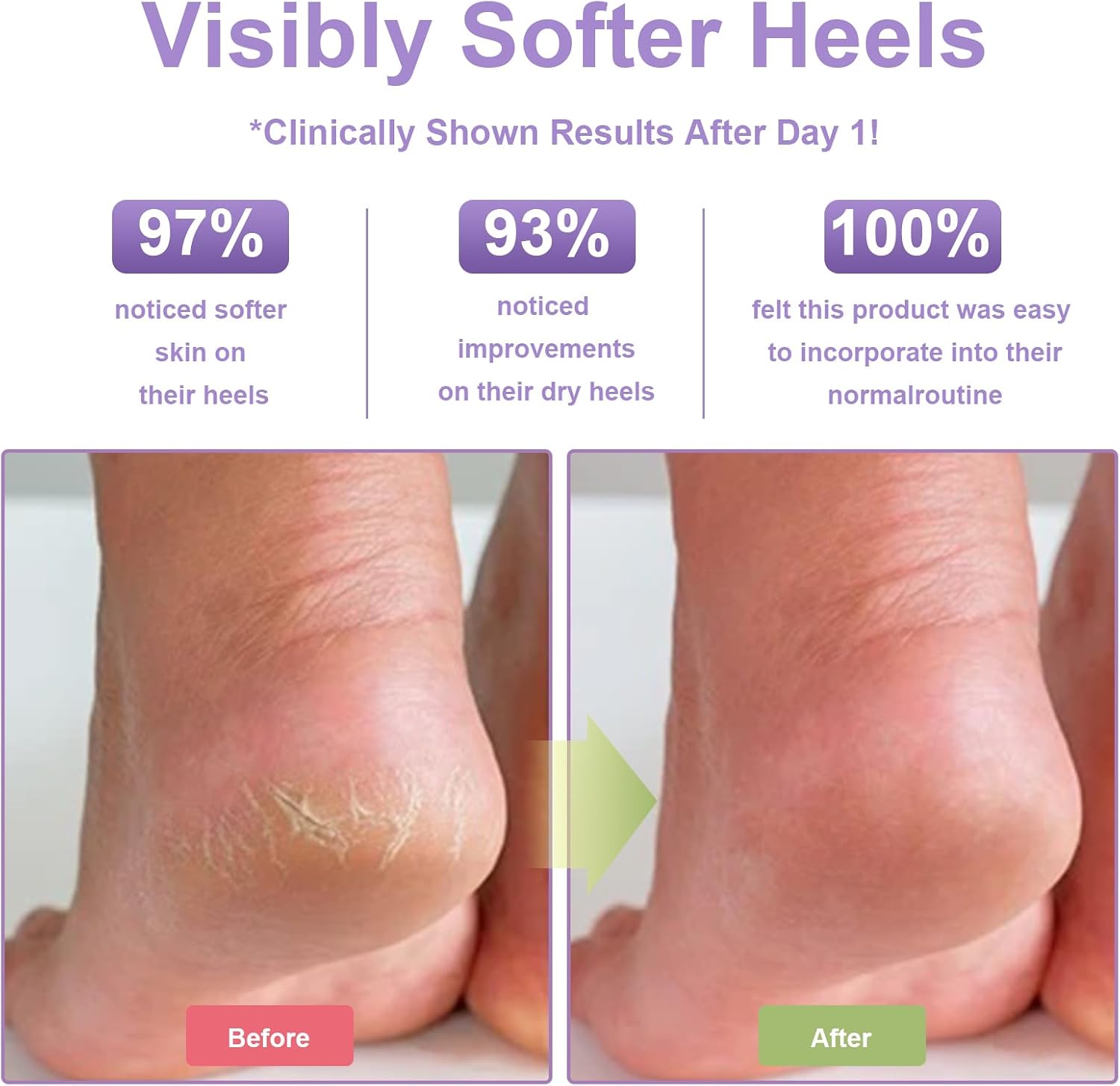 2 Pairs Moisturizing Heel Socks for Cracked Heel Treatment with Jojoba Oil, Olive Oil and Vitamin E