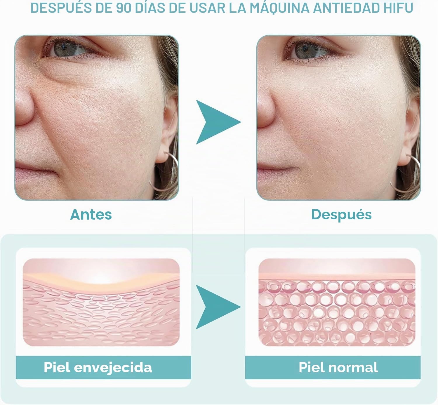 Mini máquina facial HIFU, dispositivo de belleza ultrasónico RF mejorado con tecnología de masaje facial EMS, utilizado para rejuvenecimiento de la piel antiarrugas, levantamiento, reafirmación y