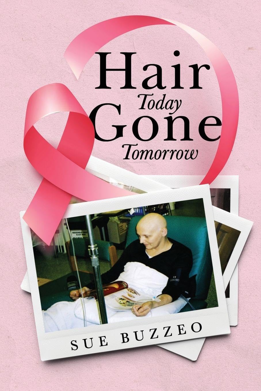 Hair Today Gone Tomorrow