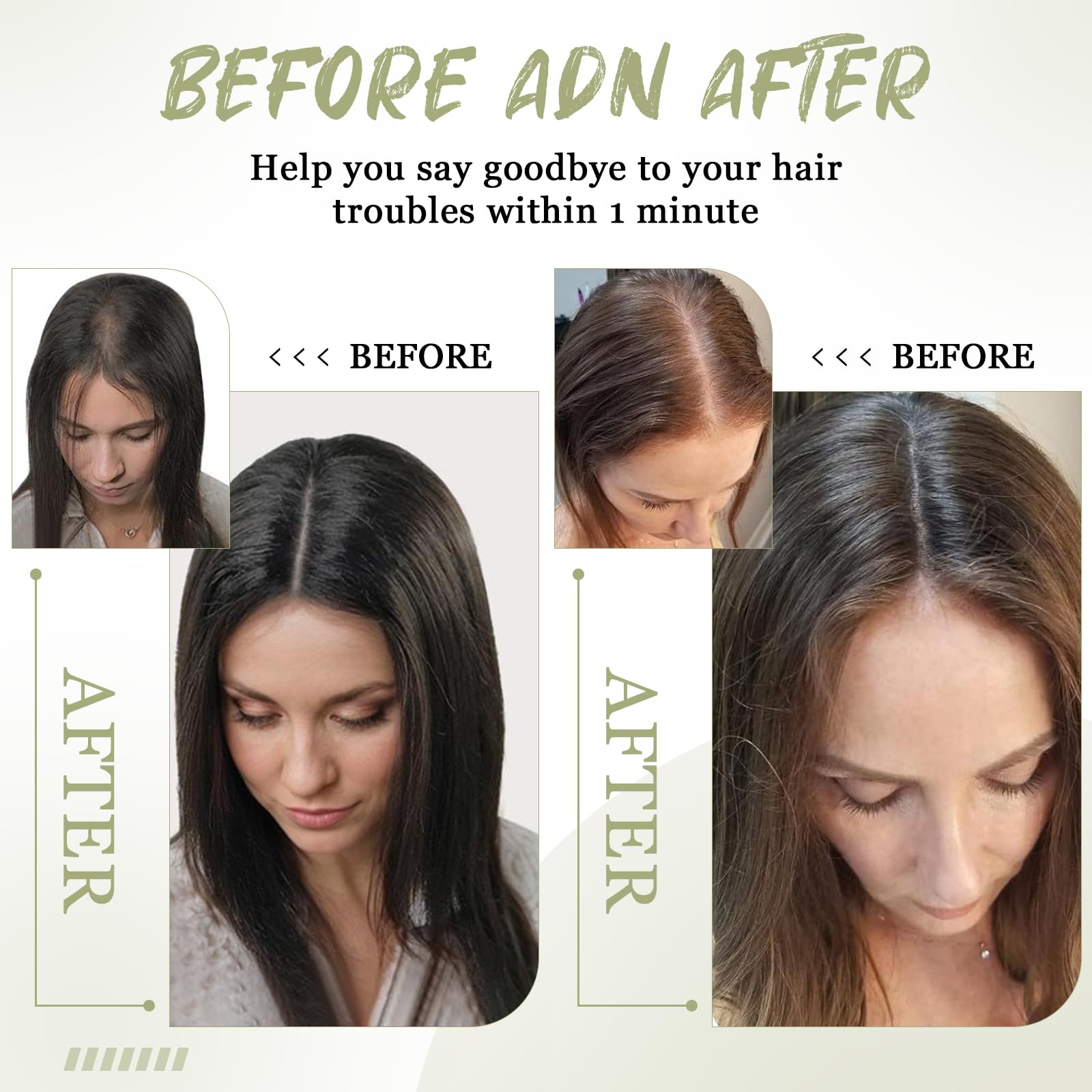Amazon.com : Urbeauty Hair Toppers for Women Real Human Hair  display picture 1