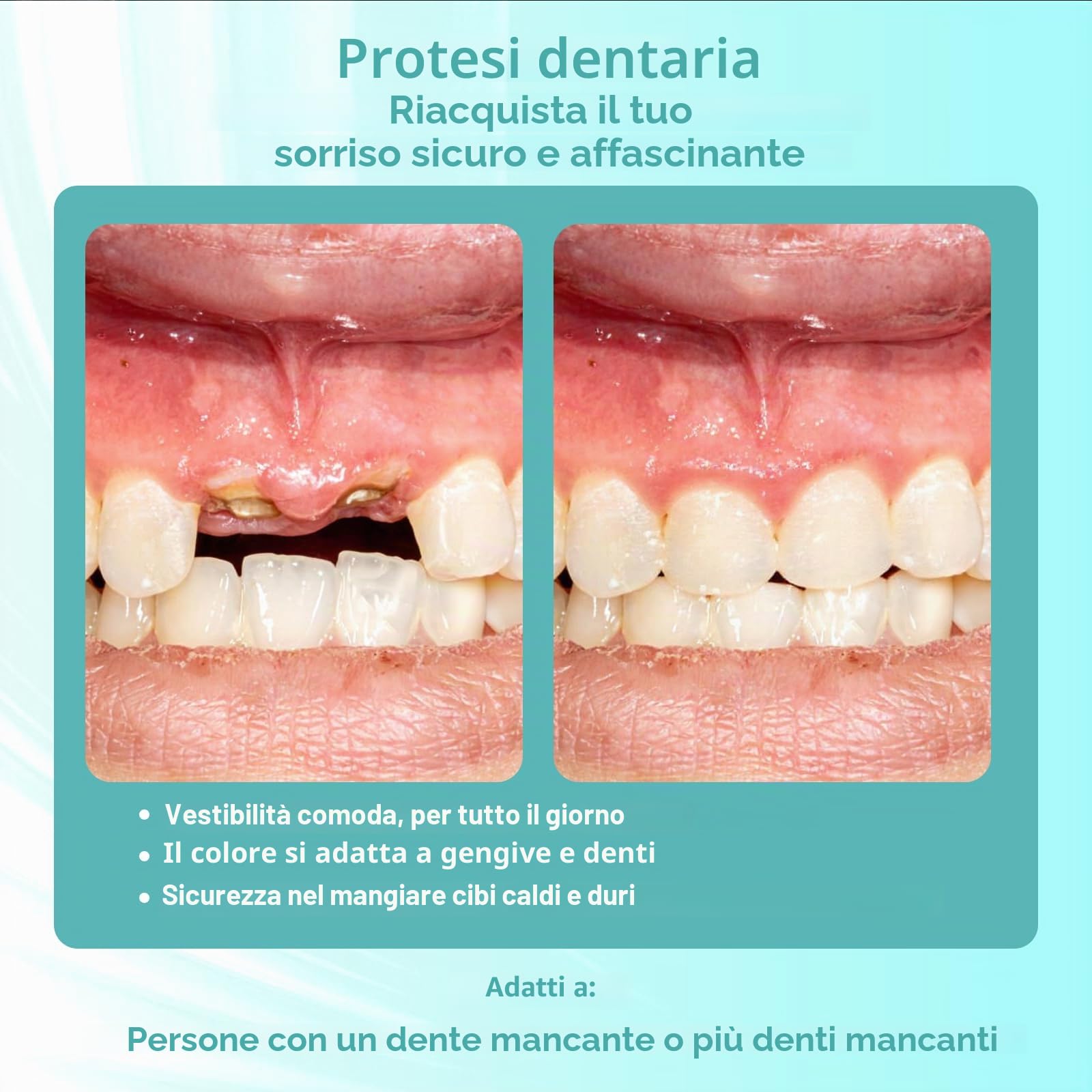 Protesi parziale su misura per gli spazi dentali: protesi provvisorie rimovibili per uomini e donne, protesi dentali con vestibilità perfetta. Facile da usare per il tuo sorriso perfetto a casa (2