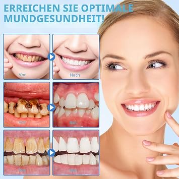 Hydroxylapatite Toothpaste Pack of 2 Fluoride-Free 9.9% Nano Hydroxyapatite Toothpaste Helps Remineralisation Protects Enamel Relieves Sensitivity Strengthens Teeth Oral Care