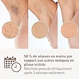 Philips Lumea série 9900 - épilateur à lumière pulsée, alternative à l'épilation laser, SenseIQ et SkinAI, 2 embouts pour le corps et le visage, BRI950/02 - 4