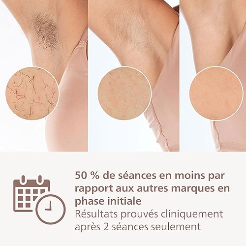 Philips Lumea série 9900 - épilateur à lumière pulsée, alternative à l'épilation laser, SenseIQ et SkinAI, 2 embouts pour le corps et le visage, BRI950/02 - 4