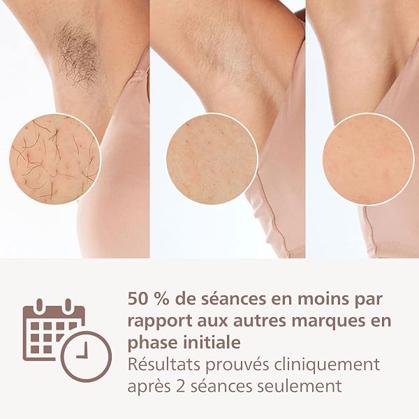 Philips Lumea Epilateur à lumiere pulsee Serie 8000 - Epilateur avec technologie SenseIQ, 2 embouts pour le corps et le visage, utilisation filaire (modèle BRI944/00) - 5