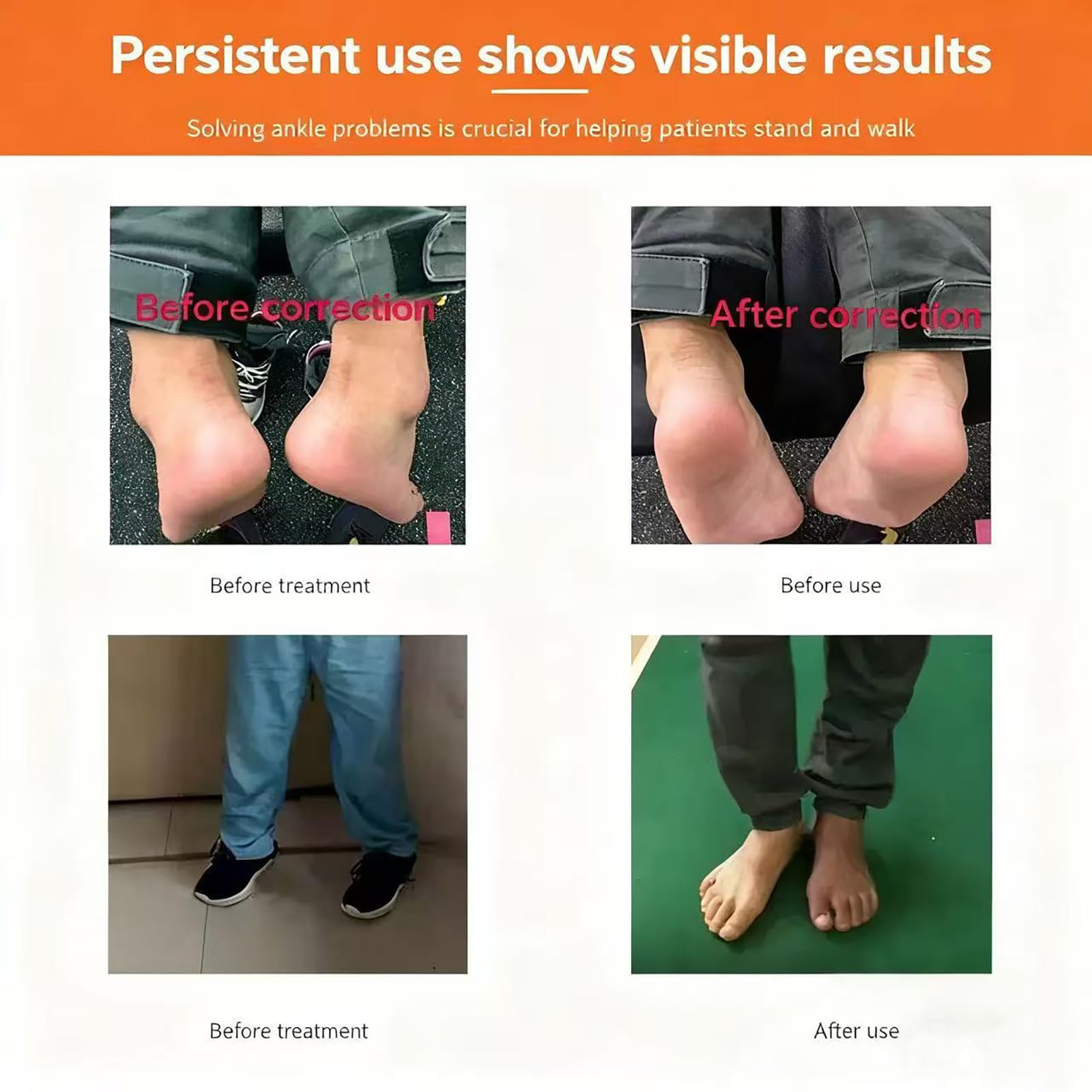 Entrenador de rehabilitación de tobillo: ortesis ajustable de tobillo con placa de ángulo de 75°, diseño mecánicamente estable y cómodo para corrección de caída del pie