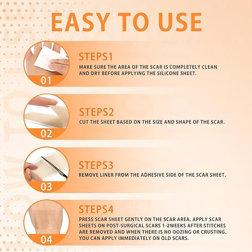Miniatura 4 de Puzeku Cinta de silicona para cicatrices de 1.6 x 120 pulgadas de largo  Hojas de silicona para cicatrices de grado médico, cinta de cicatriz