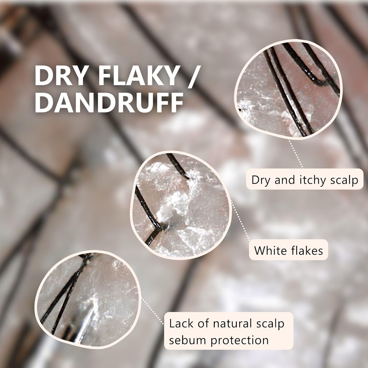 Aromase Dry Scalp Soothing Shampoo - Hydrates, Relieves Dryness and Itchiness - Amino Acid-Based Formula - No Parabens, SLS, or Silicone - 14 oz - Image 3