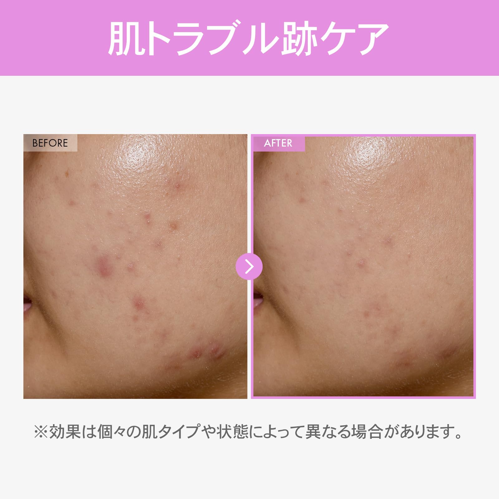 TOSOWOONG Ultimate Hydration & Skin Renewal Duo: Hyaluronic Acid 9 Cream & 9 Peptide Skin Booster Serum für einen strahlenden Teint