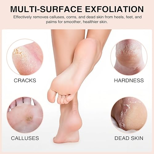 Miniatura 2 de Juego de piedras pómez naturales, paquete de 3 limas de lava volcánica de forma ovalada para callo, maíz, talón agrietado y exfoliación de piel