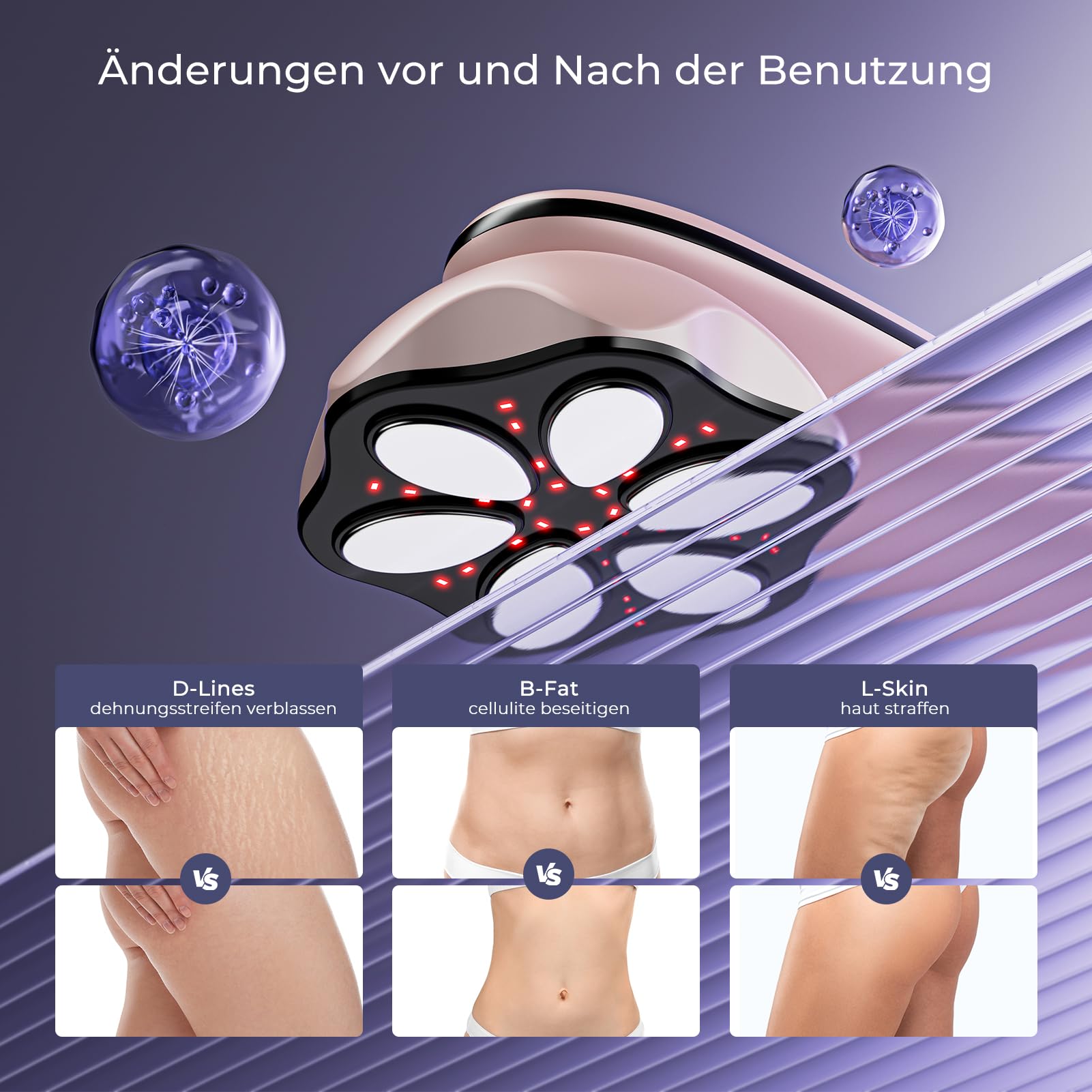 Cellulite Massagegerät Anti Lipödem Handmassagegerät, Nachgewiesene Wirksamkeit, mit 6 MassageköPfen, Geeignet für Bauch, Taille, Arme, Beine, Gesäß (Roségold)