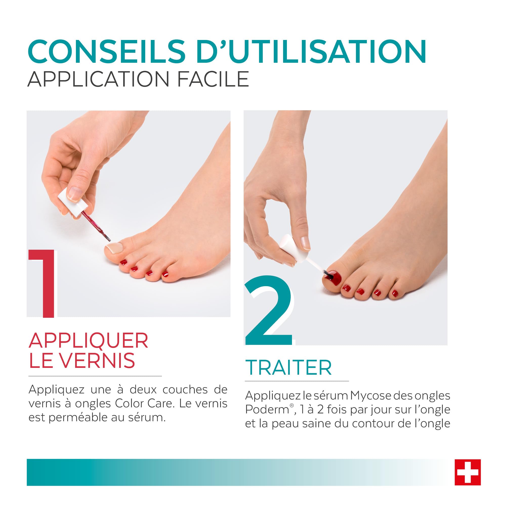 PODERM Sérum Mycose des Ongles + Vernis à Ongles Rose – Antifongique, Répare & Camoufle les Ongles Jaunis, pour des Ongles Visiblement Plus Sains | Développé par une Podologue | Swiss Made