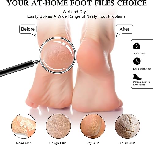Miniatura 4 de HOFASON 10 limas de pies, limpiador profesional de pies, herramientas de pedicura para pies, colosal de doble cara para piel muerta para mujeres,