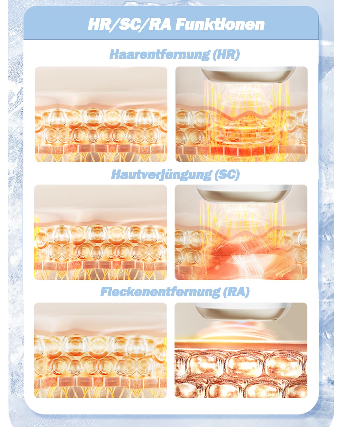 IPL Geräte Haarentfernung Laser mit Kühlfunktion, 470-1100NM Effizientes IPL Haarentfernungsgerät, mit 3-In-1 Funktionen, 9 Energiestufen, 990.000 Lichtimpulse, für Damen Männlich Gesicht Ganzkörper