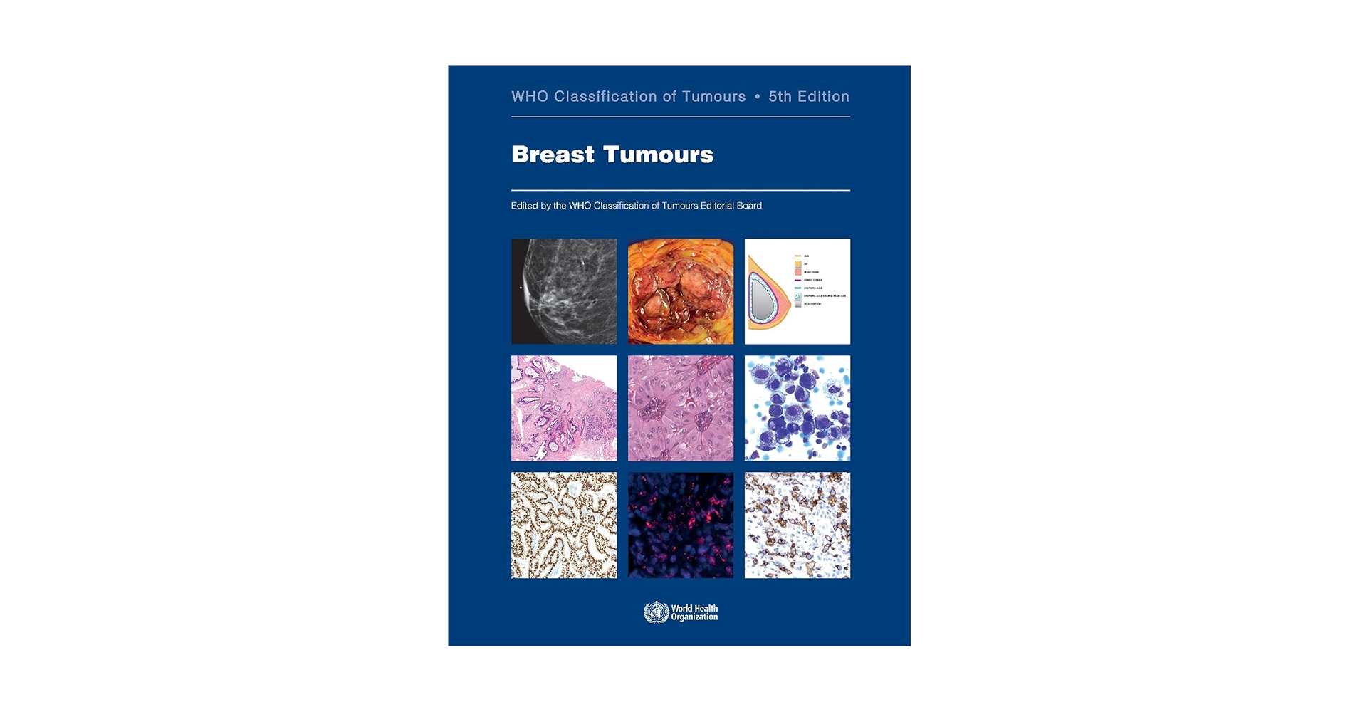 語学+参考書 Pathology And Genetics of Tumours of the Breast &amp; Female Genital Organs (World Health Organization Classification of Tumours S.) IARC Publications Website - WHO Classification of Tumours of