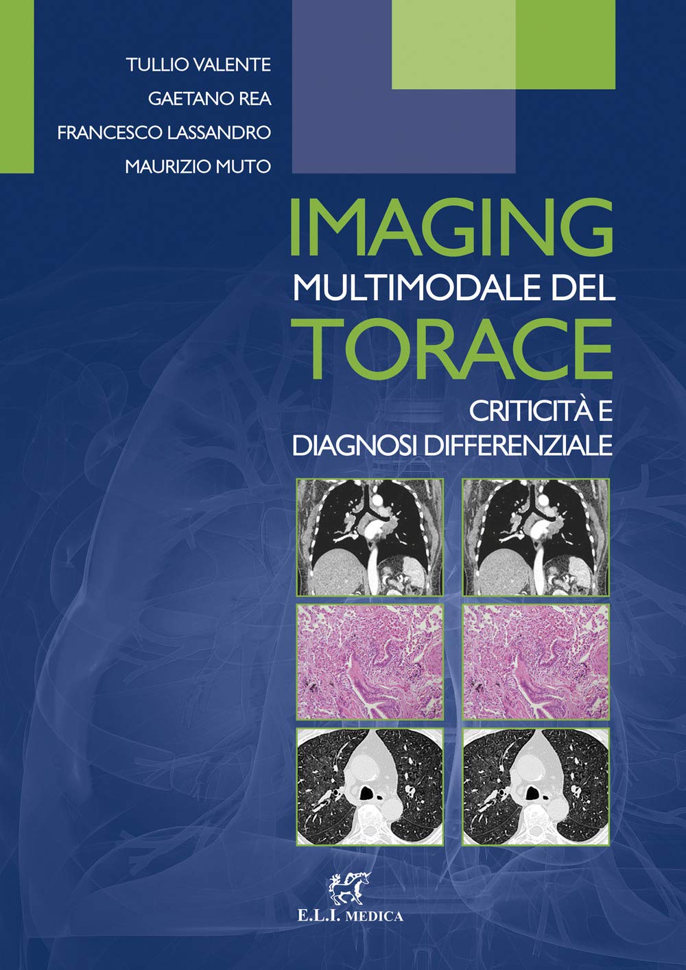 Imaging Multimodale Del Torace. Criticità E Diagnosi Differenziale - 4