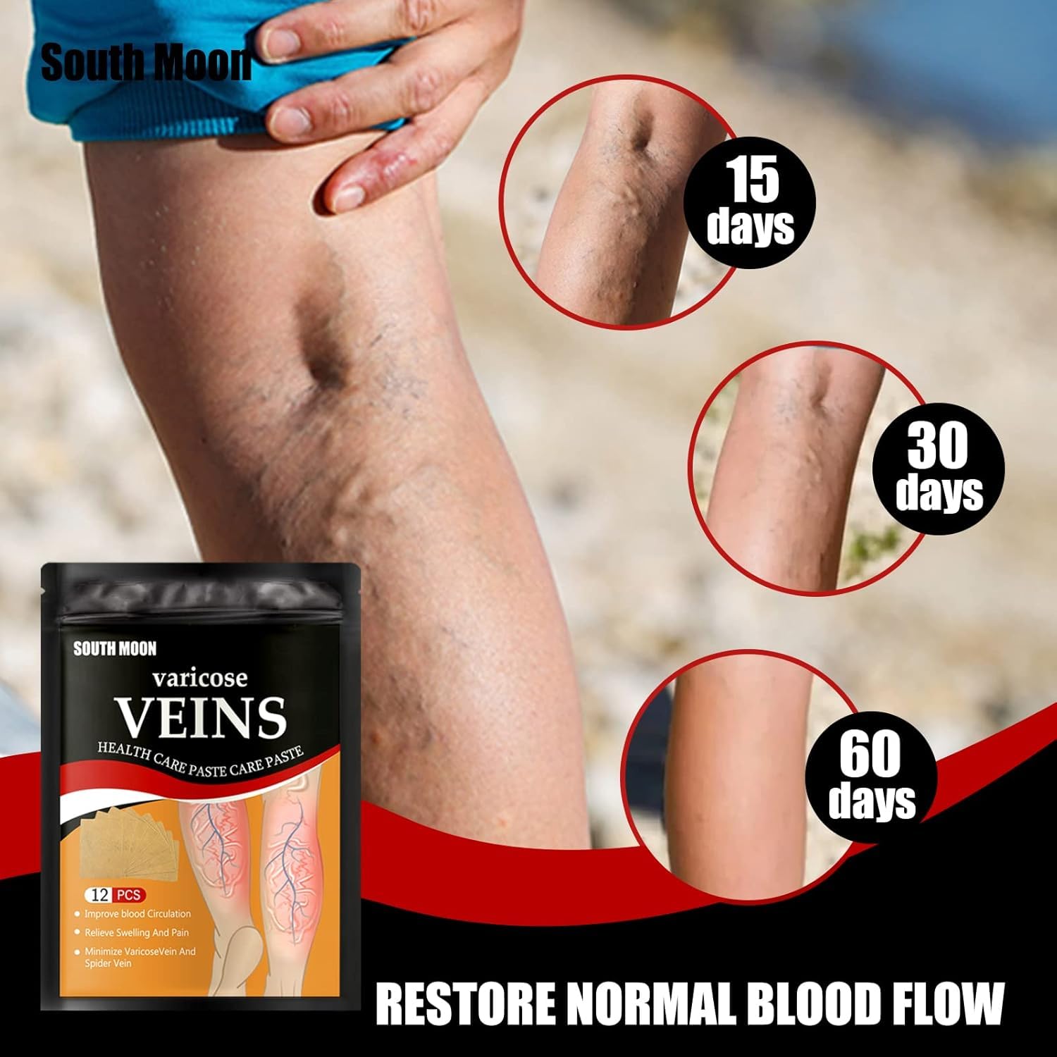 Orbica Varicose Veins Patches | Skin-Friendly, Non-Toxic Relief for Varicosity, Swelling, Muscle & Joint Pain | Instant Pain Relief & Improved Circulation (Pack Of 1-12 Pcs) 2