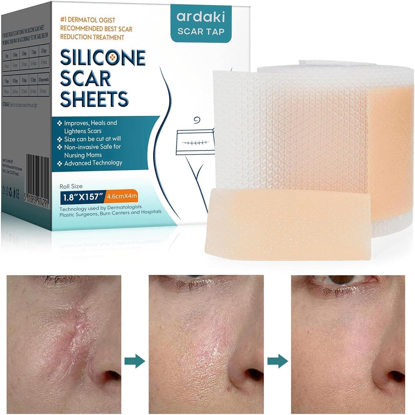 New Scar Removal Tape Scar Removal Sheet Strips for C-Section, Acne Scars, Tummy Tuck, Keloid and Surgical Scars, Reusable Medical Grade Silicone Scar Tape, Get Scars Away Painless Reusable