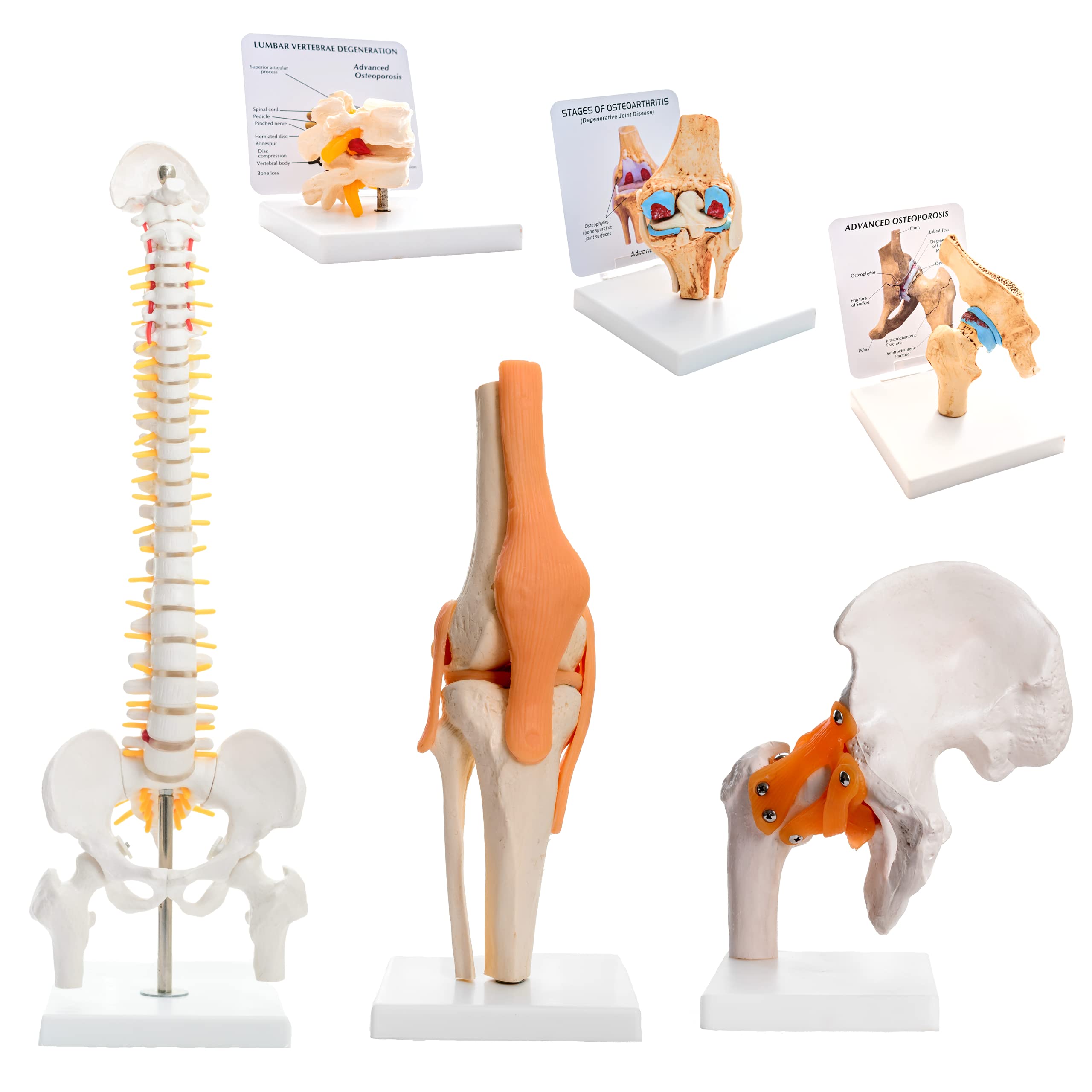 Kay Kay Industries (Set of 6)- 45 cms Spine Model, Life Size Hip Joint Model, Life Size Knee Joint Model, Advanced Stage Osteoarthritic Vertebrae, Knee & Shoulder Joint Combo, Anatomically Accurate (B09H9LPPKV) Amazon Price History, Amazon Price Tracker