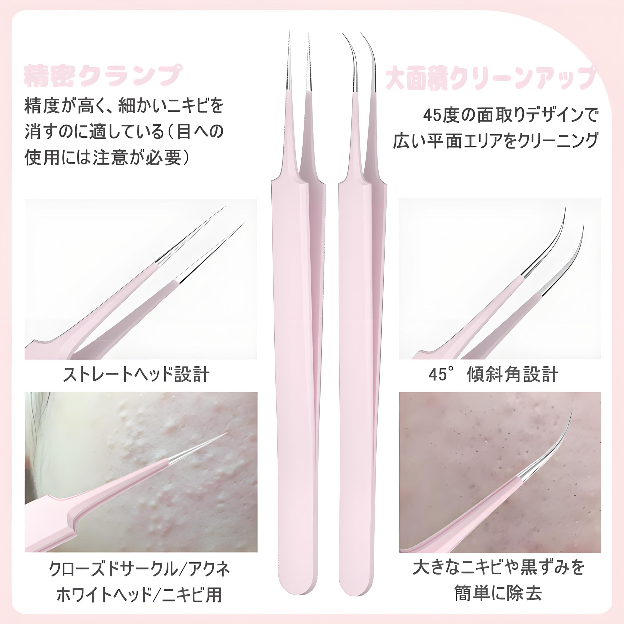Amazon.co.jp: GLOWZEN Blackhead Remover Acne Needle Tweezers (8 Amazon.co.jp: GLOWZEN Blackhead Remover Acne Needle Tweezers (8