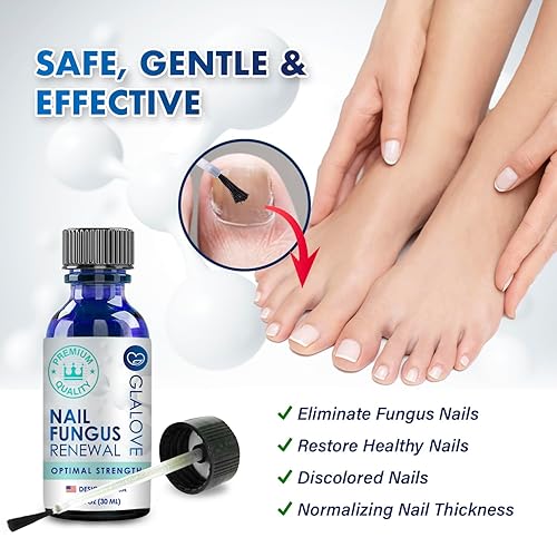 Miniatura 2 de Tratamiento de hongos en las uñas de los pies extra fuerte tratamiento de hongos en las uñas de acción rápida - Tratamiento de hongos en las uñas de