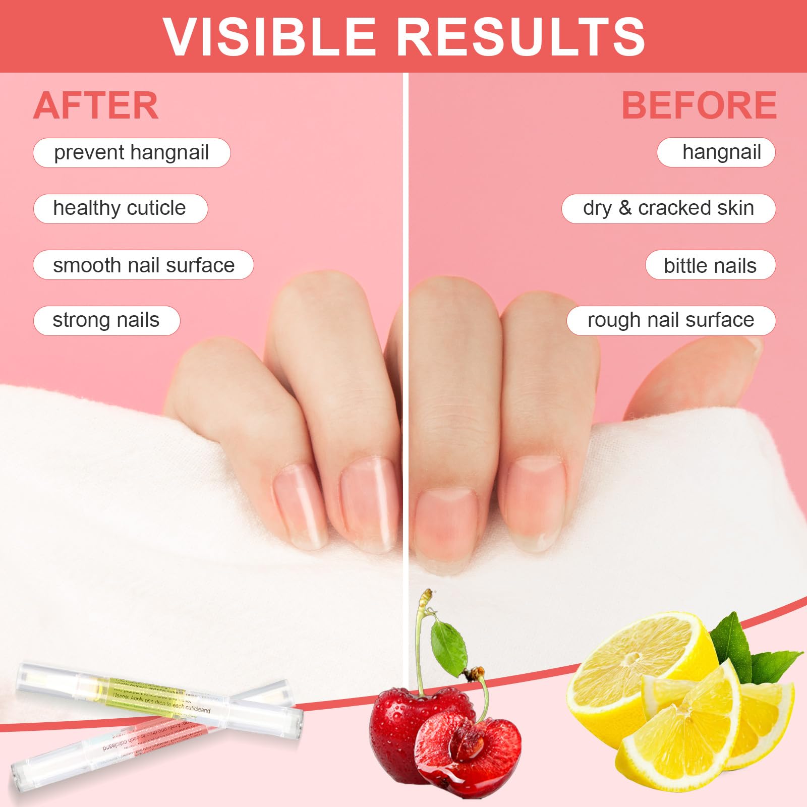 Stylo à huile à cuticules,Stylo à huile de nutrition 3PCS avec lime à ongles,Huile à cuticules pour ongles,Cuticule à l’huile pour ongles pour réparer les ongles fissurés et secs
