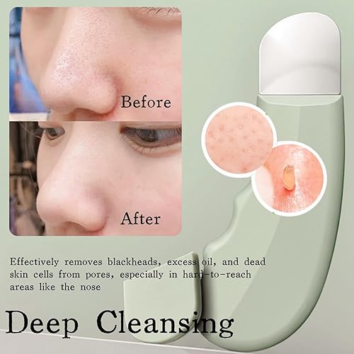 Miniatura 3 de Herramienta removedor de puntos negros, espátula facial reutilizable para limpieza profunda, herramienta de cuidado de la piel para hombres y