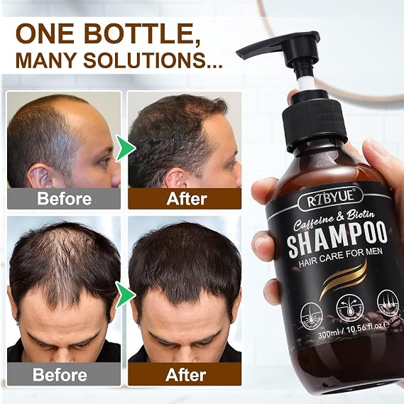 Caffeine Hair Growth Shampoo with Biotin- Anti-Hair Loss Treatment for Thinning Hair, Stimulates Follicles & Reduces Shedding for Men & Women - 300ml