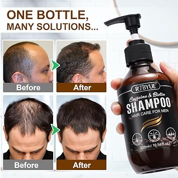 Caffeine Hair Growth Shampoo with Biotin- Anti-Hair Loss Treatment for Thinning Hair, Stimulates Follicles & Reduces Shedding for Men & Women - 300ml