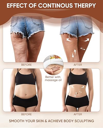 Miniatura 8 de ONUEMP Masajeador de celulitis de acero inoxidable + barra Gua Sha de acero inoxidable, masajeador de drenaje linfático, removedor de celulitis,