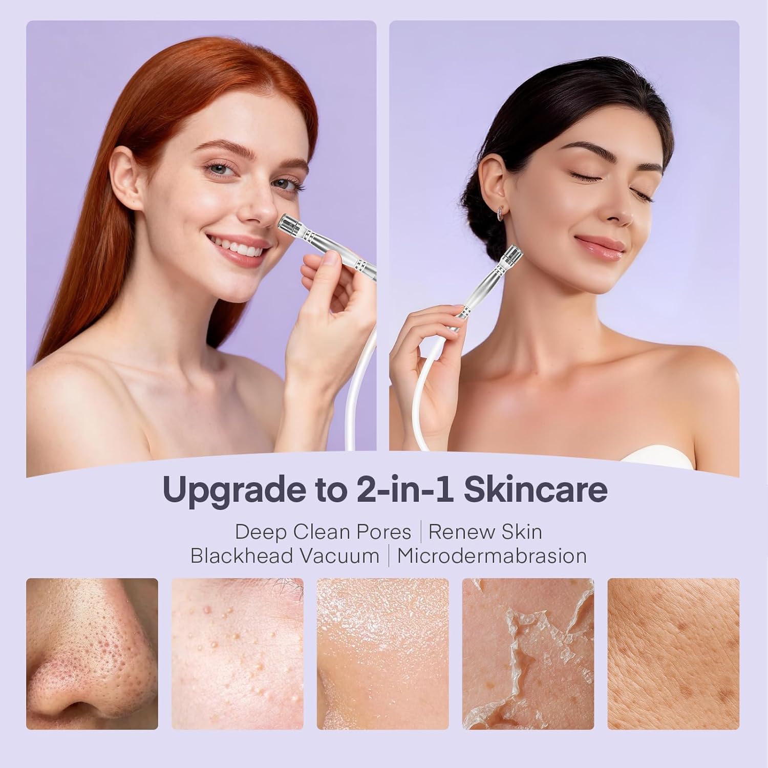Diamond Micro-dermabrasion Machine, 2 in 1 Dermabrasion Facial Machine for Exfoliation & Blackhead Removal, Home Use Facial Skin Care Device - Image 2