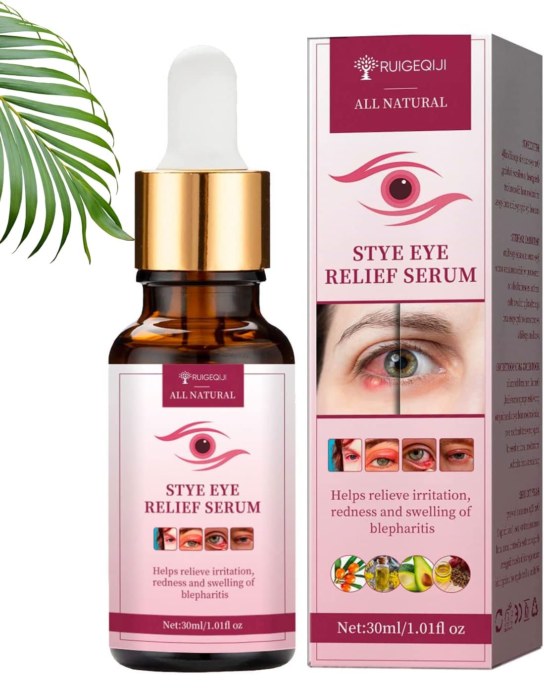 Stye Eye Treatment, Eye Stye Remover, Chalazion Remover, Stye Eye
