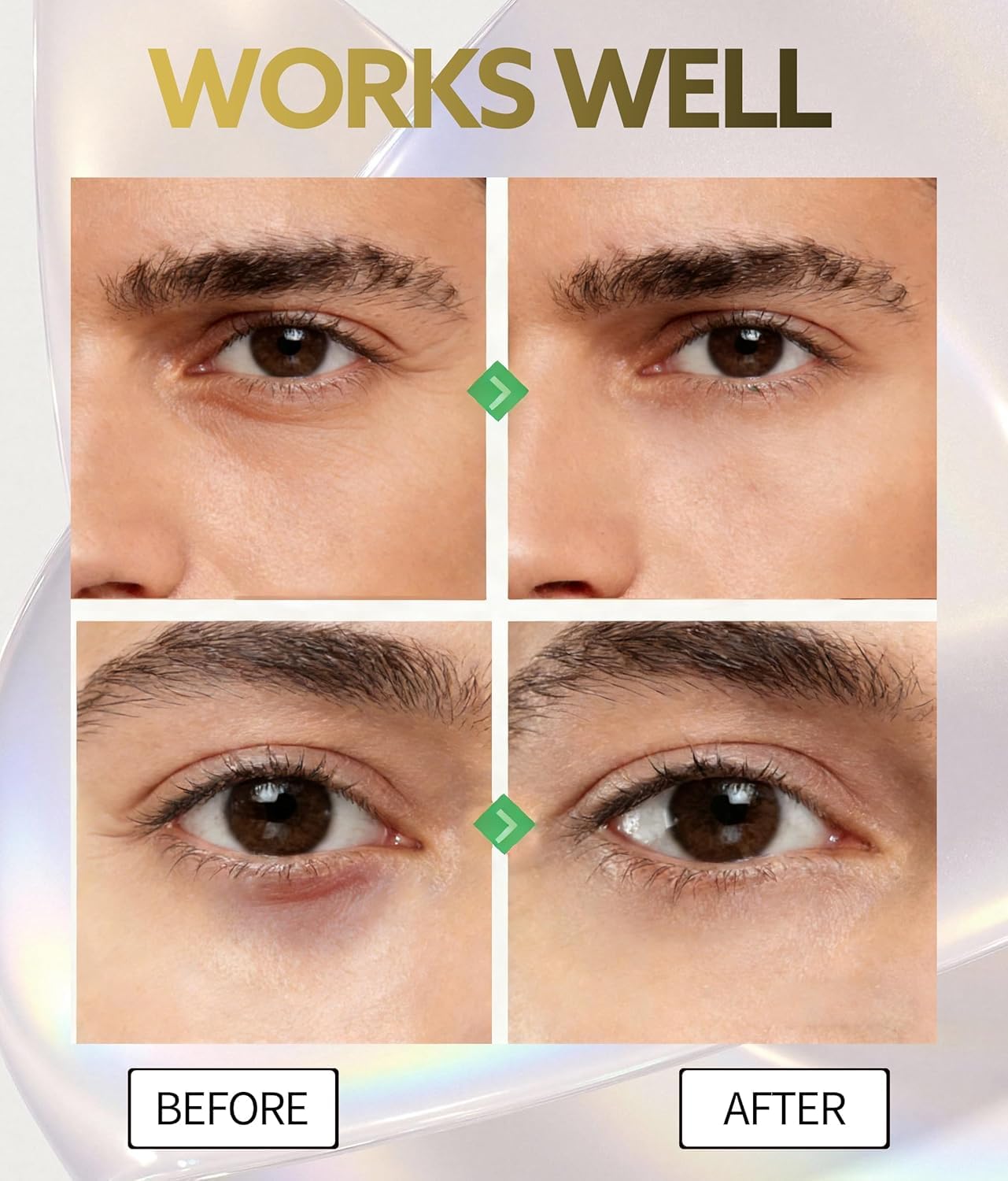 Eye Bags Treatment for Men and Women, Caffeine Eye Serum for Dark Circles and Puffiness, Dark Circles Under Eye Treatment, Under Eye Cream for Wrinkles and Fine Lines