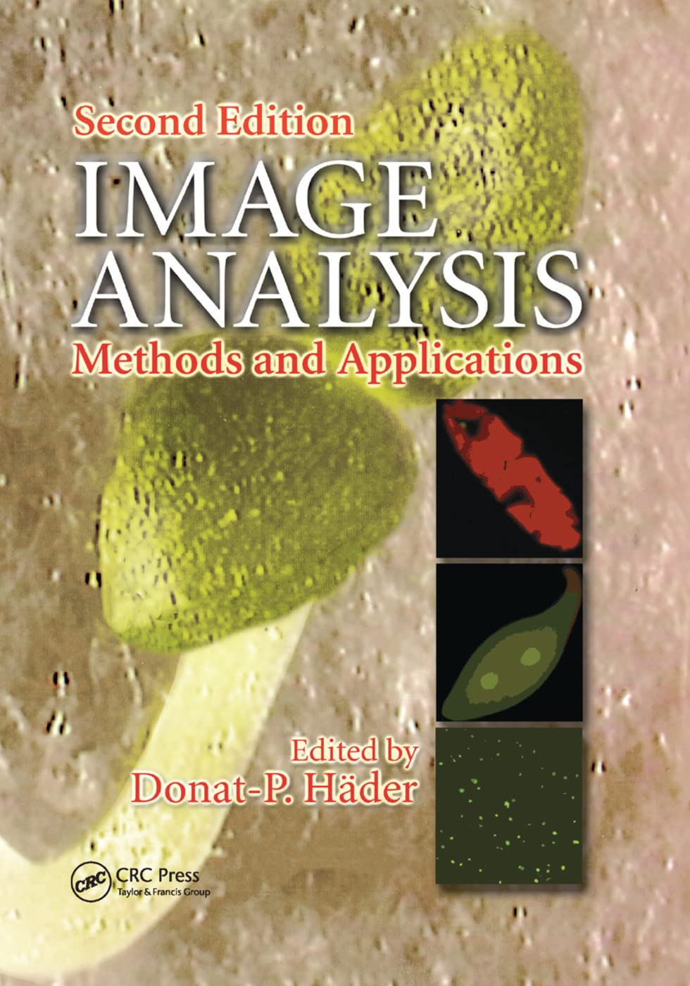 Image Analysis in Biomedical Engineering