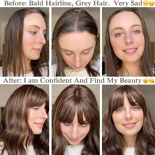 Miniatura 3 de Molefi Toppers de cabello para mujer, cabello humano real con flequillo, extensiones de cabello superior para cabello fino, pelucas de cabello Remy