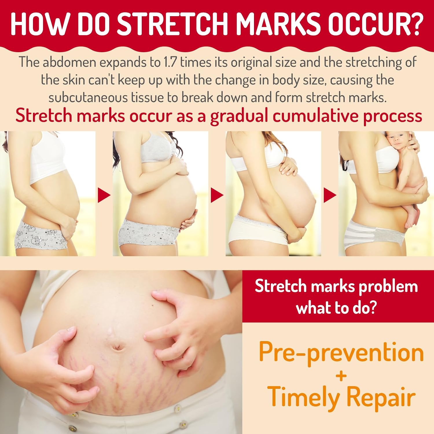 Stretch Mark Cream for Pregnancy Massages Body & Reduces Scar Appearance, Removes Stretch Mark Prevention, Prenatal & Postnatal Tummy Skin Care, Firming Skin Elasticity for Maternity (3.38 Fl Oz)